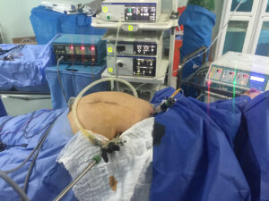 Laparoscopic cholecystostomy